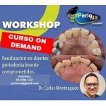 Ferulizacion en dientes periodontales comprometidos $USD